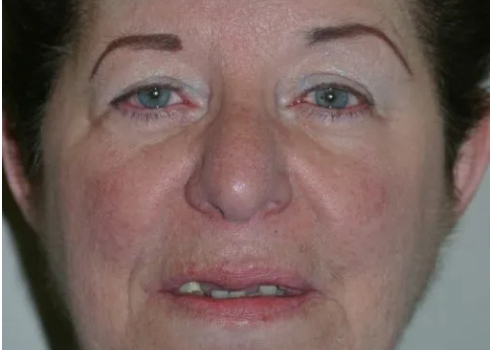 Case kathy before query